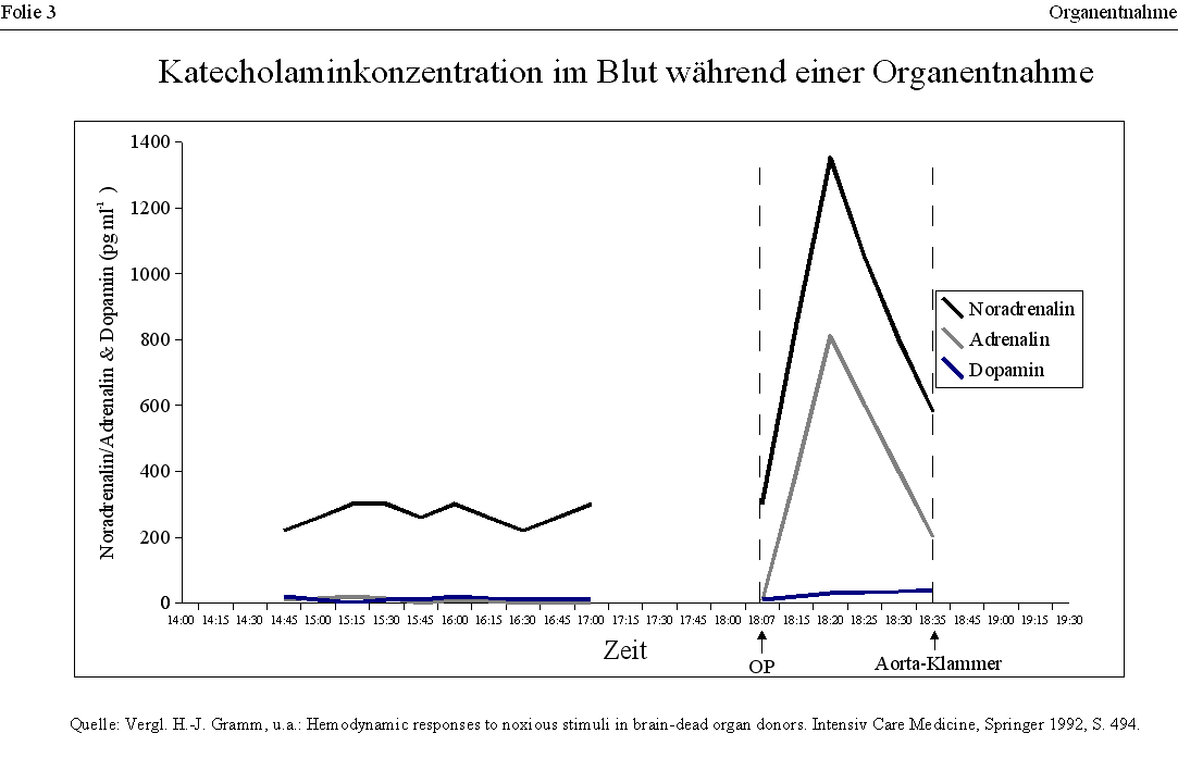 Organentnahme: Anstieg der Katecholaminkonzentration im Blut