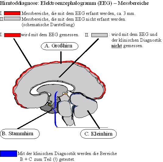 Messbereiche bei der Hirntoddiagnostik (EEG-Messung und klinische Diagnostik